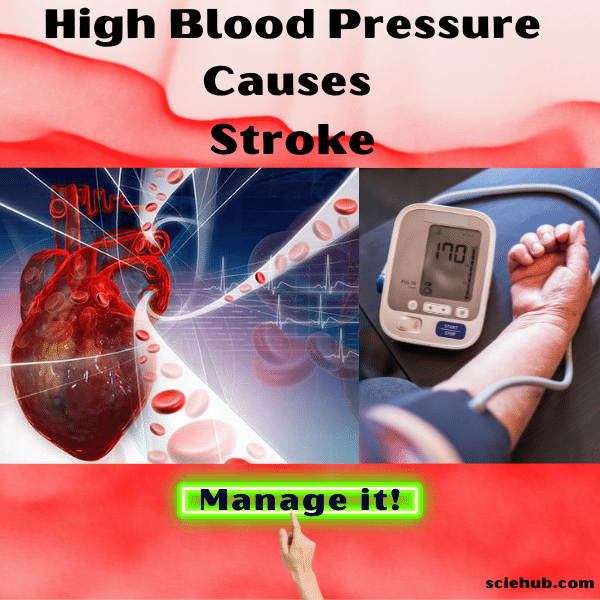 High Blood Pressure Causes Stroke